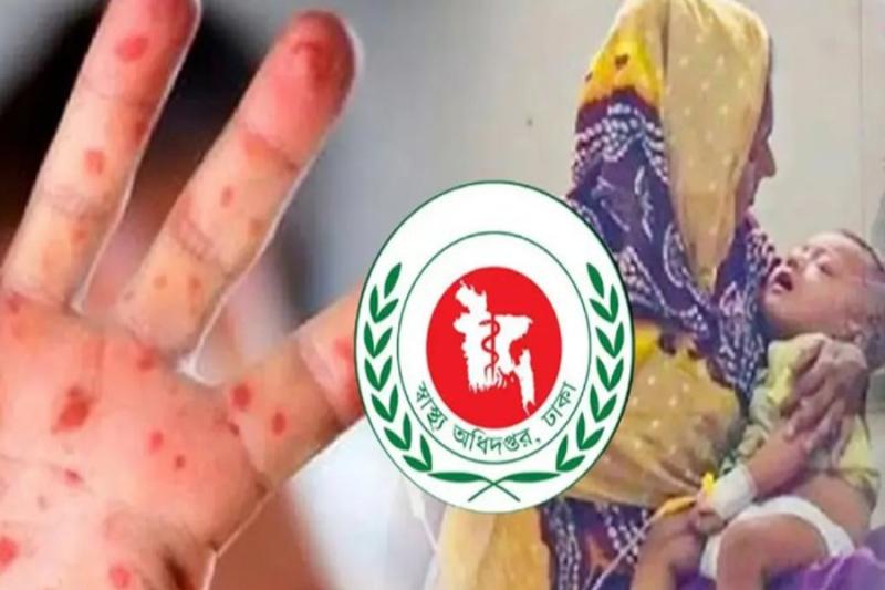 measles-outbreak-13-more-children-die-death-toll-crosses-500.jpg